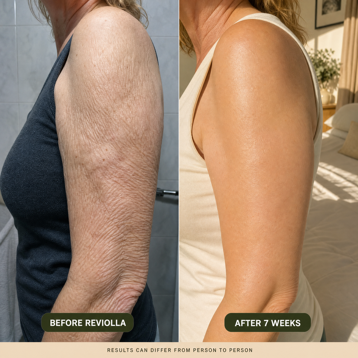Peptide Body Oil — for Crepey & Thinning Skin